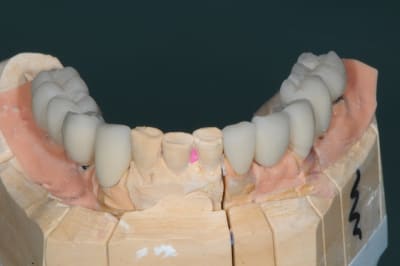 Dsc 9964 vww4ro - Eugenol