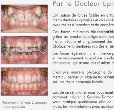 Damon pub d9hpoj - Eugenol