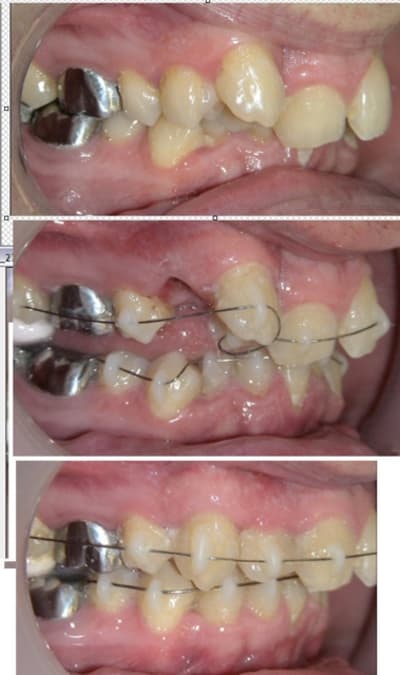 Danchamon2 rdtip1 - Eugenol