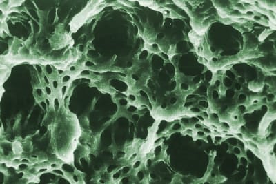 Dentine  01bis swlnsn - Eugenol