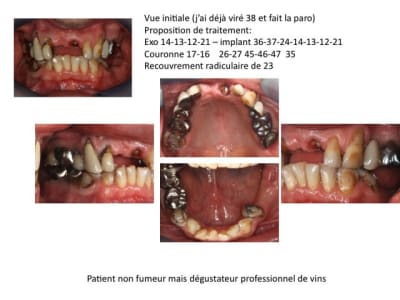 Diapositive1 dpumyp - Eugenol