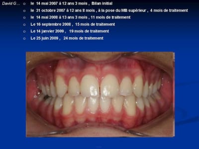 Diapositive6 emgrvw - Eugenol