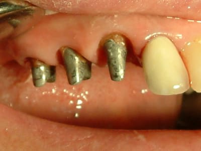 Dscf0010 ewoel2 - Eugenol