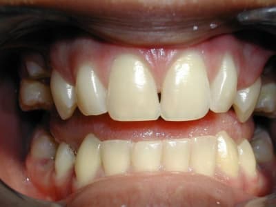 Dscn1264 yjnepm - Eugenol