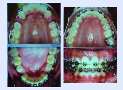 En cours et fin vz2dsb - Eugenol