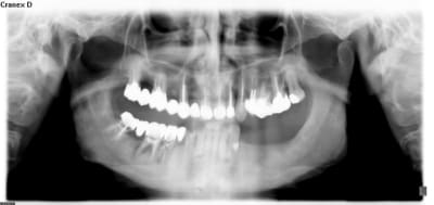 Ep opt pd0bze - Eugenol