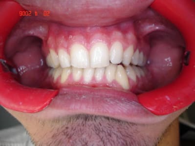 Exemple 2 mrxepg - Eugenol