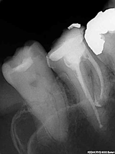 Endo4 ewzixh - Eugenol