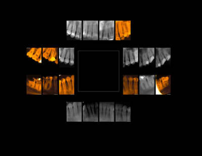 F1 caien diavkb - Eugenol