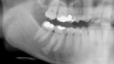 Fonson z2xrwa - Eugenol