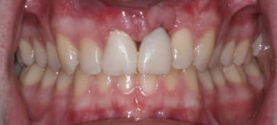 Face11 21 smqkex - Eugenol