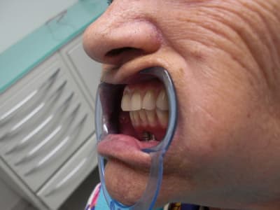 Fin2 brlpyj - Eugenol