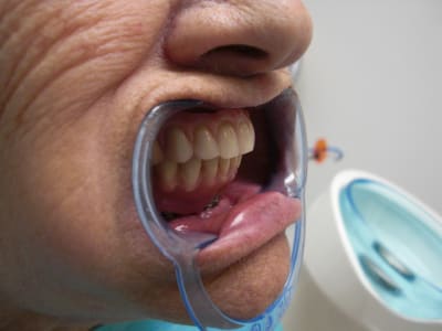 Fin3 kr8hhc - Eugenol