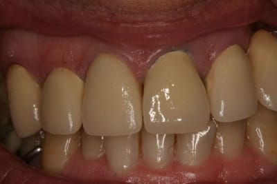 Fini  1  xy8wah - Eugenol