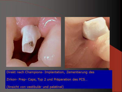 Folie15 fwul1m - Eugenol