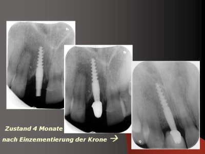 Folie18 gzd0ce - Eugenol