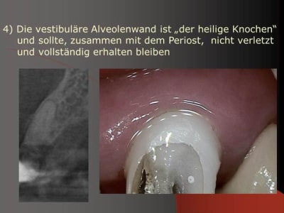 Folie6 gyvgz6 - Eugenol