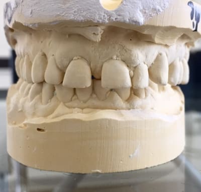 Fullsizerender  5  vwcrxd - Eugenol