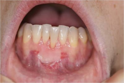 Gec8 d8miai - Eugenol