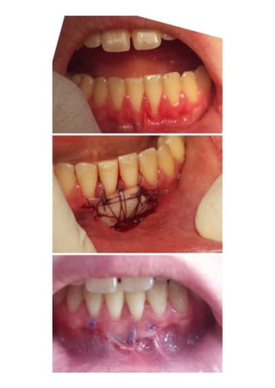 Gec tylad7 - Eugenol