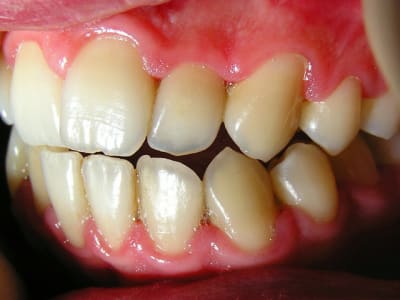 Gun j 9 2 fnnrrb - Eugenol