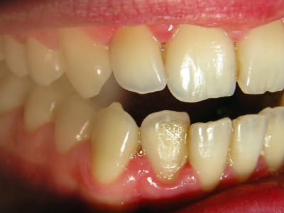 Gun j 9 3 eorhts - Eugenol