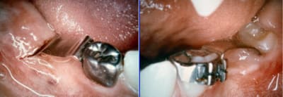 Guides hlkqy4 - Eugenol