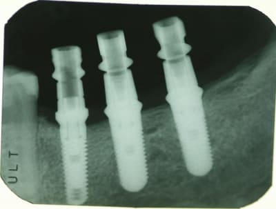 Id et zimmer hpj1a3 - Eugenol