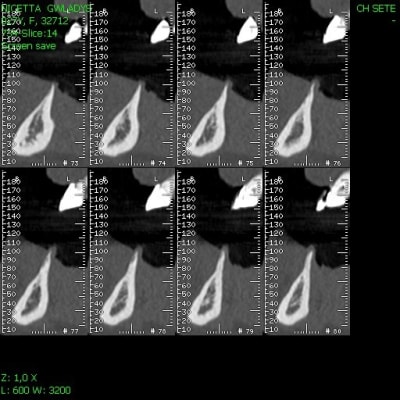 Img13 roafkk - Eugenol