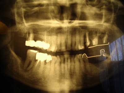 Imgp0230 cgtpup - Eugenol