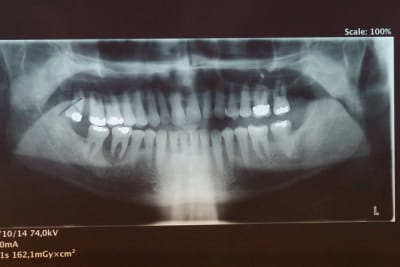 Imgp1370 vcf4vw - Eugenol