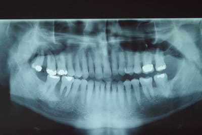 Imgp1398 pgwdc4 - Eugenol