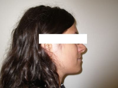 Imgp8143 wzbq8u - Eugenol