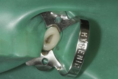 Img 0011 g3zodc - Eugenol