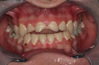 Img 0012red excd4b - Eugenol