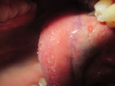 Img 0037 l6wmi7 - Eugenol