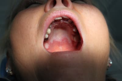 Img 0043 jyvplz - Eugenol