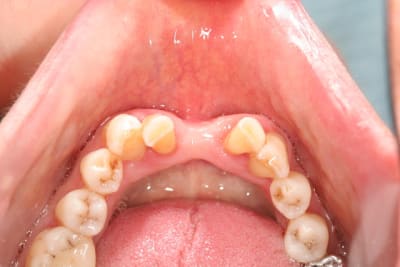 Img 0064 fykvs7 - Eugenol