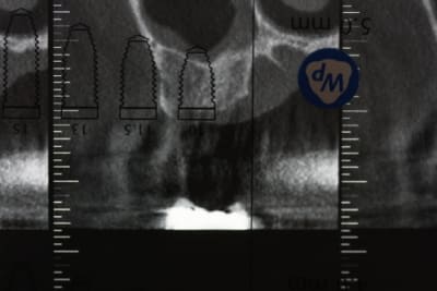 Img 0100 aeb9tf - Eugenol