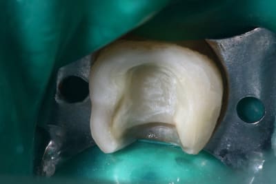 Img 0127 cytmj4 - Eugenol