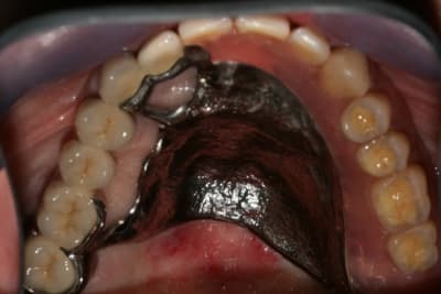 Img 0156 reqfrd - Eugenol