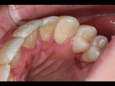 Img 0233 640x480 zguagm - Eugenol