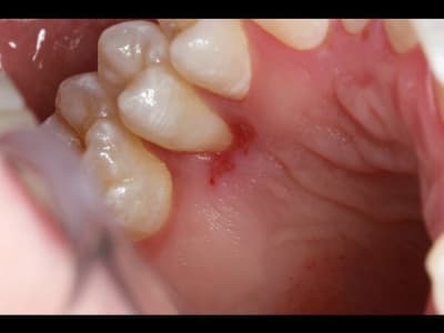 Img 0238 640x480 nn4vnm - Eugenol