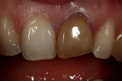 Img 0262 syyw98 - Eugenol