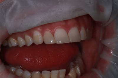 Img 0265 dyiket - Eugenol