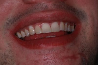 Img 0266 iyvstm - Eugenol