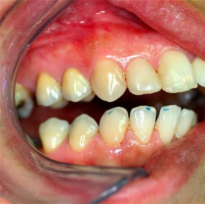 Img 0283 small lr69am - Eugenol