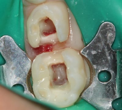 Img 0381 qf9orz - Eugenol