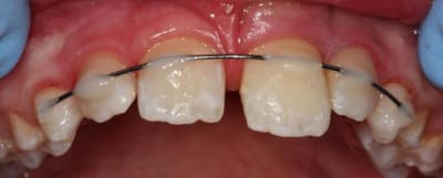 Img 0418 awvn9n - Eugenol