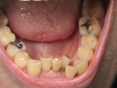 Img 0481 xlgjtf - Eugenol